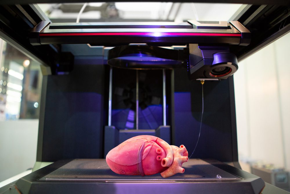 3D-printed organs